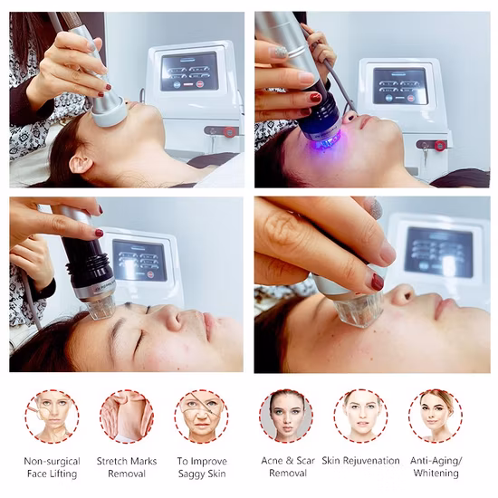 Micro Needling Hautstraffung Falten Dehnungsstreifenentfernung RF Microneedling Fractional RF Microneedle Fractional RF Microneedle Machine Beauty Machine
